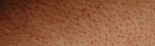 pexels-photo-6642970-6642970 Detailed close-up view of human skin surface showing natural texture and imperfections.