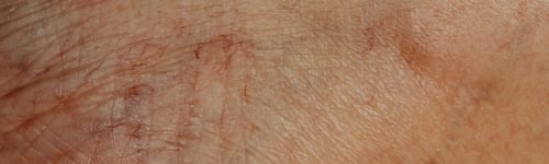 pexels-photo-6643071-6643071 Detailed close-up image highlighting the texture and wrinkles of aging human skin.